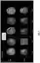 Fig. 05 - 3D radiomic platform for imaging biomarker development