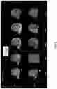 Fig. 06 - 3D radiomic platform for imaging biomarker development