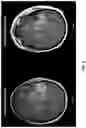 Fig. 07 - 3D radiomic platform for imaging biomarker development