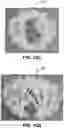 Fig. 29 - SYSTEM AND METHOD FOR BUILDING ELECTROMAGNETIC COIL STRUCTURES