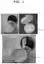 Fig. 02 - Cosmetics having impregnation member with recessed pattern formed on surface therof by laser processing