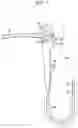 Fig. 02 - Ultrasonic endoscope