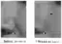 Fig. 01 - METHOD OF SKIN REJUVENATION USING STEM CELL ENGRAFTMENT