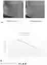 Fig. 07 - METHOD OF SKIN REJUVENATION USING STEM CELL ENGRAFTMENT
