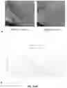 Fig. 08 - METHOD OF SKIN REJUVENATION USING STEM CELL ENGRAFTMENT