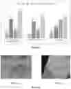Fig. 02 - Cosmetic Composition for Keloid Scar Improvement