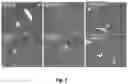 Fig. 06 - Substituted esters containing polyols and saccharides for treating hepatotoxicity and fatty liver diseases