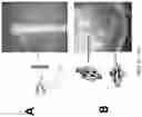 Fig. 09 - Myocyte-derived flow assist device: extravasal sheaths of rhythmically contracting myocytes aiding flow of biological fluids