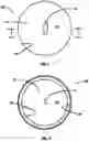 Fig. 02 - Wheel rim guard