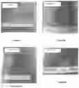 Fig. 07 - METHOD FOR PREPARING A SUPPLEMENT FROM MESENCHYMAL CELL CULTURES OF WHARTON'S JELLY AND USES OF SAME
