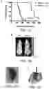 Fig. 02 - Methods and compositions for identifying and treating patients with small cell lung cancer