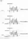 Fig. 04 - Seismic sensor and earthquake determination method