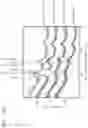 Fig. 16 - Capacitor, semiconductor device and methods of manufacturing the capacitor and the semiconductor device