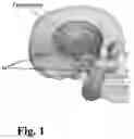 Fig. 02 - Method and system for analyzing neural and muscle activity in a subject's head for the detection of mastication
