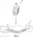 Fig. 02 - Spinal fusion implant