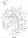 Fig. 07 - Spinal fusion implant