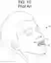 Fig. 04 - A SYSTEM FOR SLEEP-DISORDERED BREATHING TREATMENT