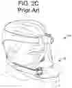 Fig. 07 - A SYSTEM FOR SLEEP-DISORDERED BREATHING TREATMENT