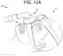 Fig. 14 - A SYSTEM FOR SLEEP-DISORDERED BREATHING TREATMENT