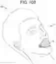 Fig. 15 - A SYSTEM FOR SLEEP-DISORDERED BREATHING TREATMENT