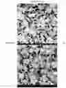 Fig. 02 - Bone substitute material
