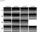 Fig. 04 - Method for producing a steel strip with an aluminium alloy coating layer