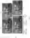 Fig. 04 - Compensating for disparity variation when viewing captured multi video image streams