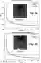 Fig. 06 - Un-supervised convolutional neural network for distortion map estimation and correction in MRI