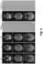 Fig. 07 - Un-supervised convolutional neural network for distortion map estimation and correction in MRI
