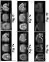 Fig. 08 - Un-supervised convolutional neural network for distortion map estimation and correction in MRI