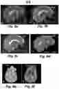 Fig. 09 - Un-supervised convolutional neural network for distortion map estimation and correction in MRI