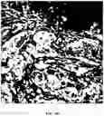 Fig. 06 - Foreground segmentation and nucleus ranking for scoring dual ISH images