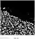 Fig. 07 - Foreground segmentation and nucleus ranking for scoring dual ISH images