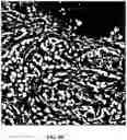 Fig. 08 - Foreground segmentation and nucleus ranking for scoring dual ISH images