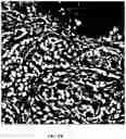 Fig. 10 - Foreground segmentation and nucleus ranking for scoring dual ISH images