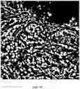 Fig. 14 - Foreground segmentation and nucleus ranking for scoring dual ISH images