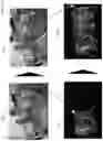 Fig. 17 - Person and projected image item tracking system