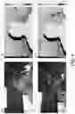 Fig. 07 - Reducing textured IR patterns in stereoscopic depth sensor imaging