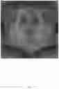 Fig. 19 - Photometric image processing