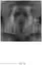 Fig. 21 - Photometric image processing