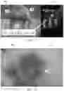 Fig. 11 - SYSTEMS AND METHODS FOR MIXED REALITY MEDICAL TRAINING
