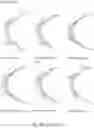 Fig. 67 - Eye mounted displays and eye tracking systems