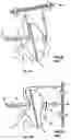 Fig. 03 - Ambient noise reduction arrangements