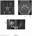 Fig. 04 - Method and system for identification of cerebrovascular abnormalities
