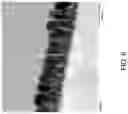 Fig. 06 - Method of forming an anode structure with dielectric coating