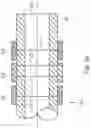 Fig. 06 - SHAPE MEMORY ANCHOR FOR UMBILICAL TERMINATION