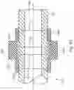 Fig. 08 - SHAPE MEMORY ANCHOR FOR UMBILICAL TERMINATION