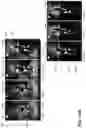 Fig. 16 - Skeleton-based effects and background replacement