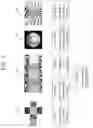 Fig. 02 - METHOD AND APPARATUS FOR OVERLAY PROCESSING IN 360 VIDEO SYSTEM