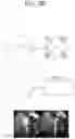 Fig. 11 - METHOD AND APPARATUS FOR OVERLAY PROCESSING IN 360 VIDEO SYSTEM